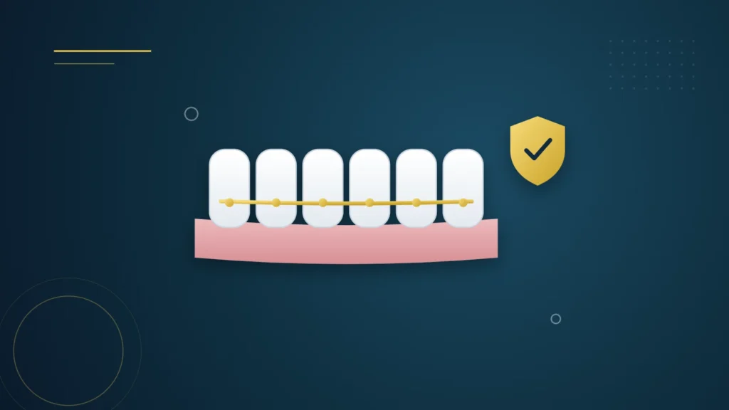 Illustration : des dents alignées maintenues par un fil de contention doré