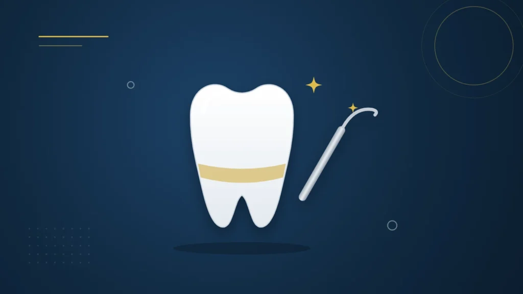 Illustration : une dent avec du tartre près de la gencive et un instrument de détartrage