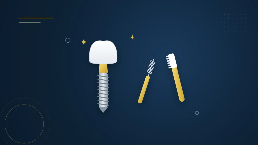 Illustration : un implant dentaire, une brossette interdentaire et une brosse à dents