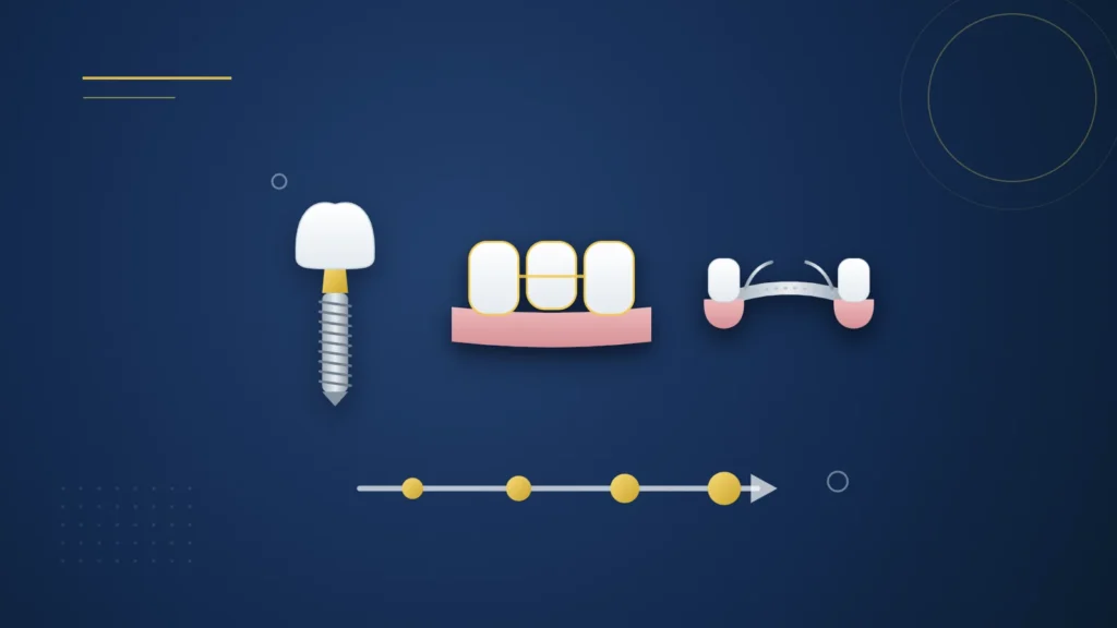 Illustration : un implant, un bridge et une prothèse partielle alignés au-dessus d'une ligne du temps